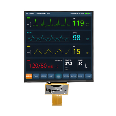 햇빛으로 읽을 수 있는 7.6 인치 TFT LCD 디스플레이 1000 닛 800x800 픽셀 사각형형 IPS 화면